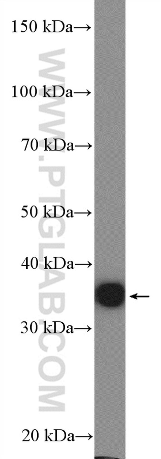 Annexin A3 Antibody in Western Blot (WB)