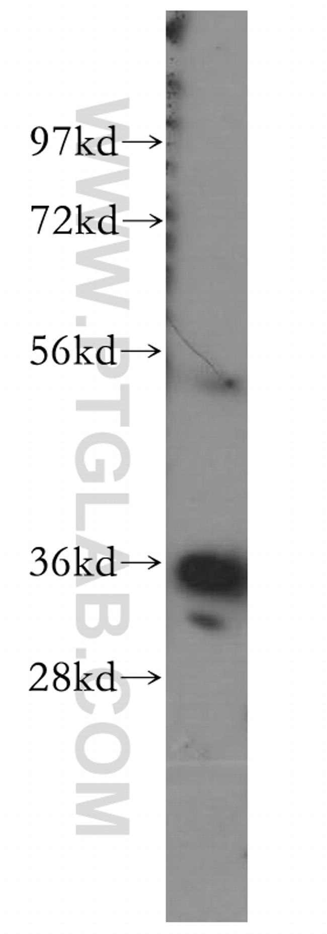 Annexin A3 Antibody in Western Blot (WB)