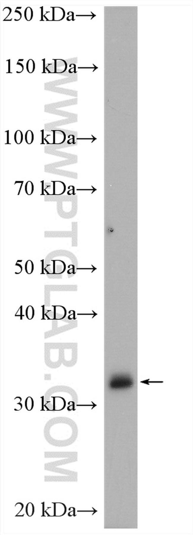 Annexin A3 Antibody in Western Blot (WB)