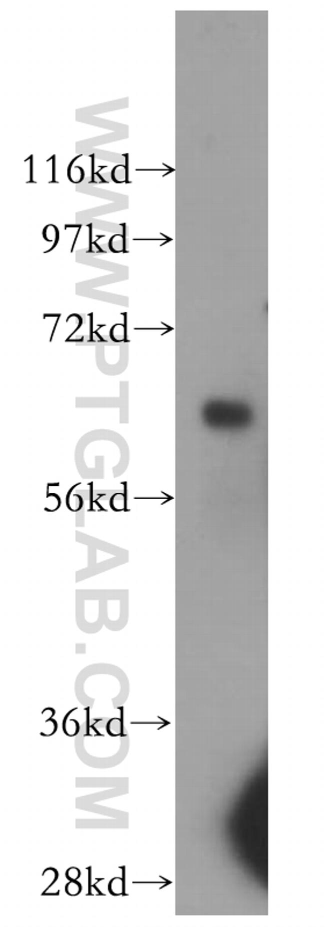 Arylsulfatase D Antibody in Western Blot (WB)