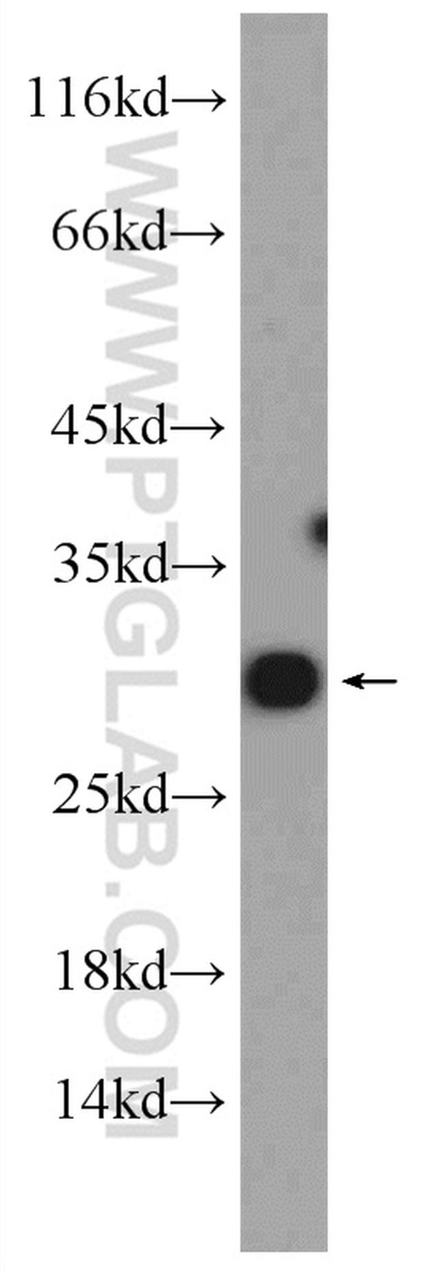 RAB10 Antibody in Western Blot (WB)