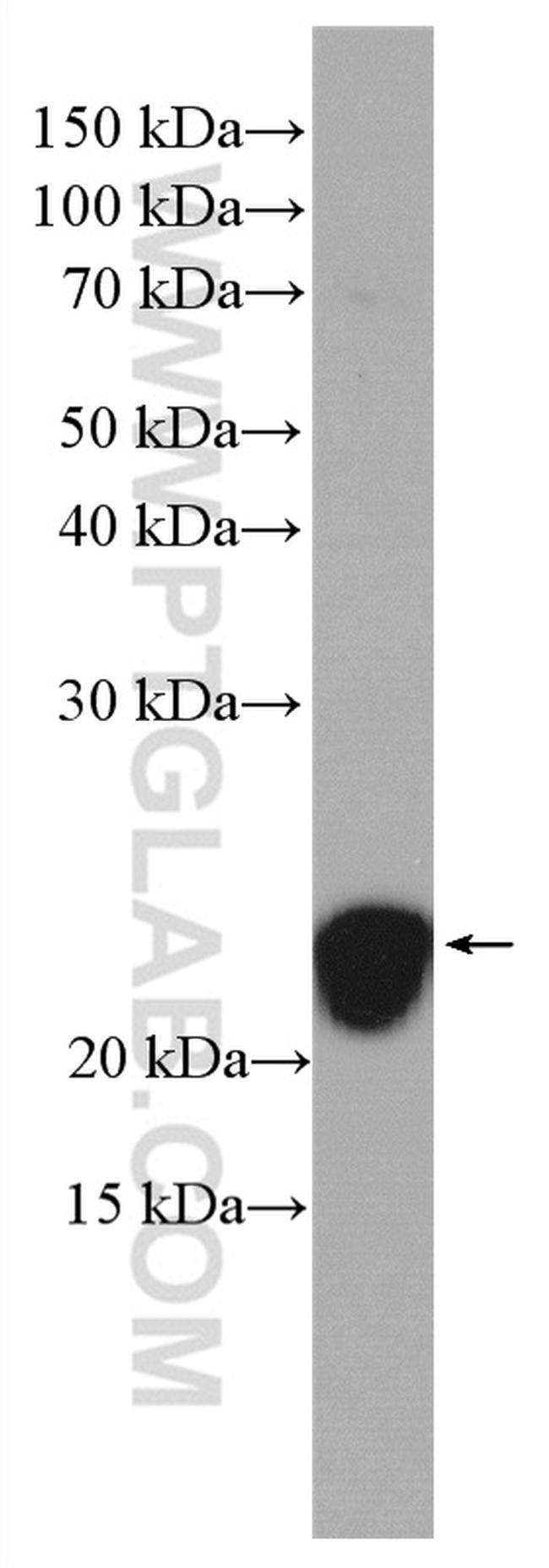 RAB10 Antibody in Western Blot (WB)