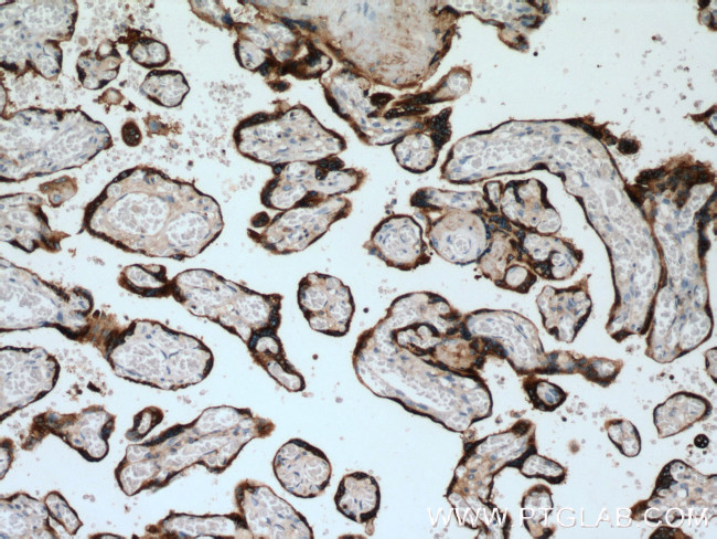 PSG1 Antibody in Immunohistochemistry (Paraffin) (IHC (P))