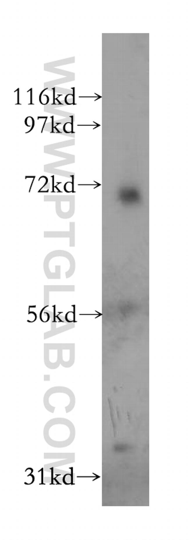 PSG1 Antibody in Western Blot (WB)