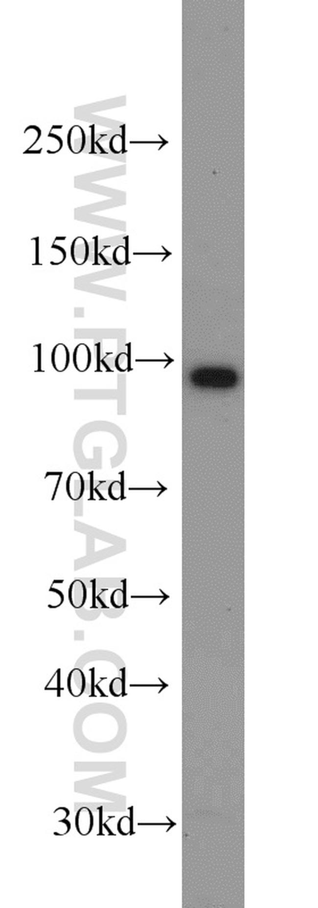 CILP2 Antibody in Western Blot (WB)