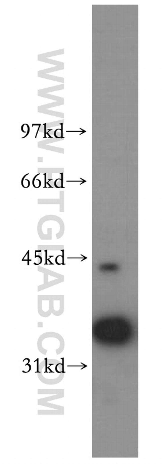 RFC3 Antibody in Western Blot (WB)
