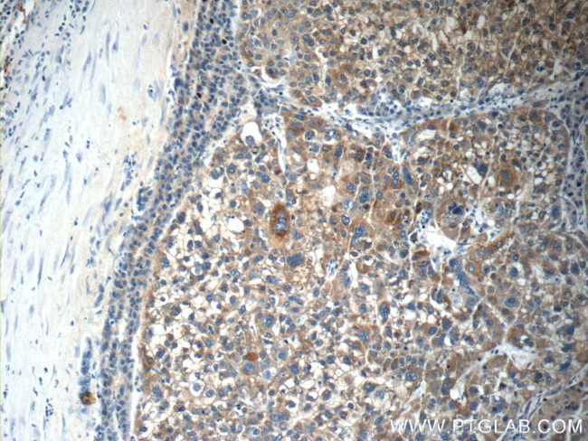 C4BPA Antibody in Immunohistochemistry (Paraffin) (IHC (P))