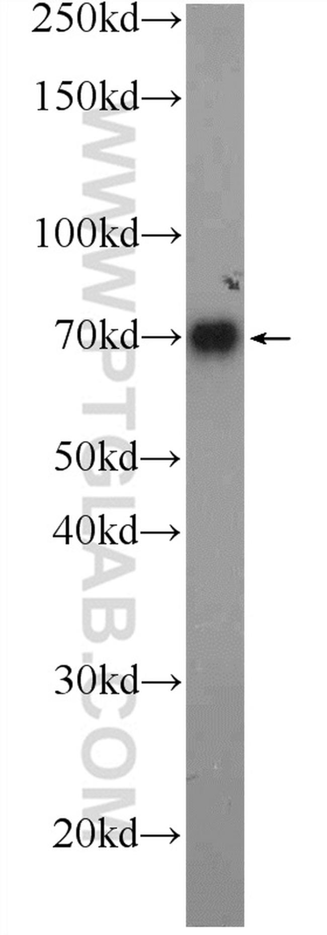 C4BPA Antibody in Western Blot (WB)