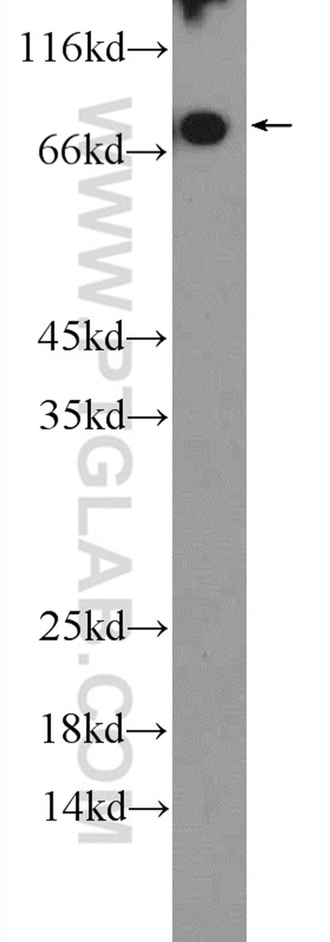 C4BPA Antibody in Western Blot (WB)