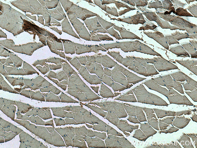 SDC4 Antibody in Immunohistochemistry (Paraffin) (IHC (P))