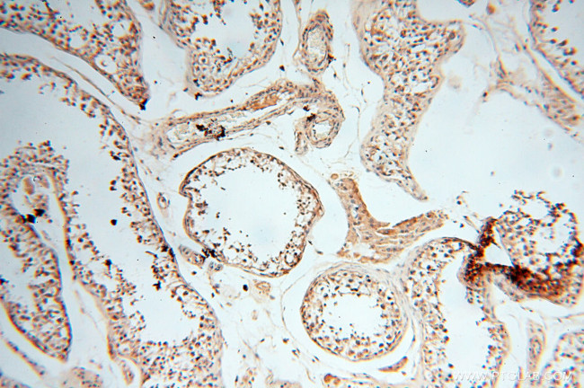 ANKRD2 Antibody in Immunohistochemistry (Paraffin) (IHC (P))