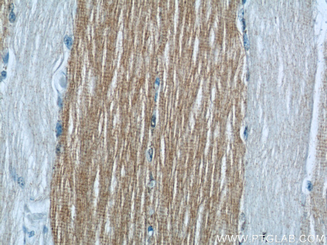 ANKRD2 Antibody in Immunohistochemistry (Paraffin) (IHC (P))