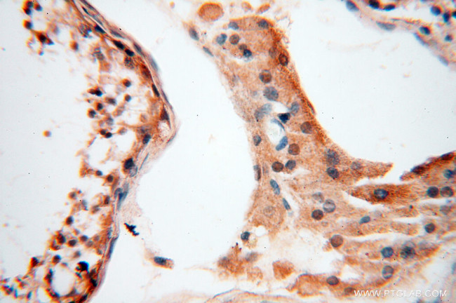 ANKRD2 Antibody in Immunohistochemistry (Paraffin) (IHC (P))