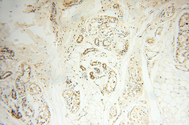 ANKRD2 Antibody in Immunohistochemistry (Paraffin) (IHC (P))