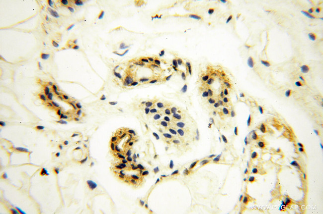 ANKRD2 Antibody in Immunohistochemistry (Paraffin) (IHC (P))