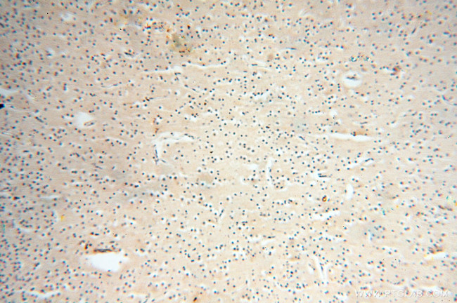 ANKRD2 Antibody in Immunohistochemistry (Paraffin) (IHC (P))