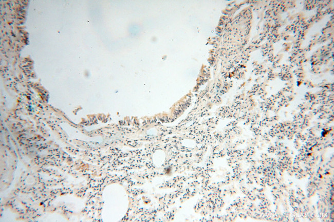 ANKRD2 Antibody in Immunohistochemistry (Paraffin) (IHC (P))