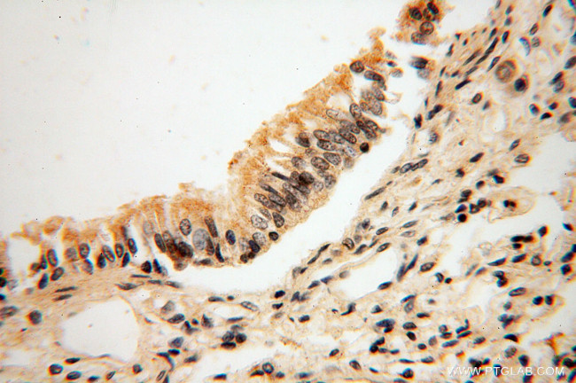 ANKRD2 Antibody in Immunohistochemistry (Paraffin) (IHC (P))