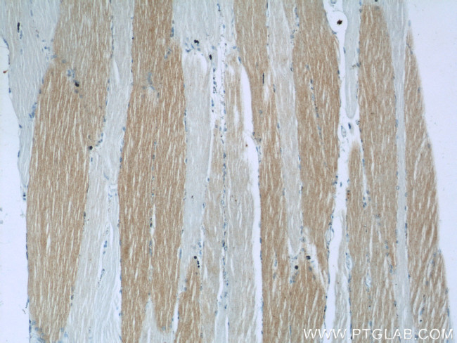 ANKRD2 Antibody in Immunohistochemistry (Paraffin) (IHC (P))