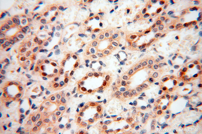 ANKRD2 Antibody in Immunohistochemistry (Paraffin) (IHC (P))