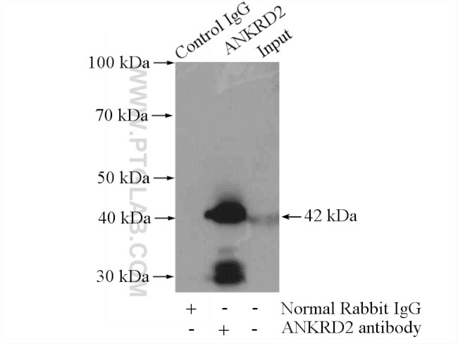 ANKRD2 Antibody in Immunoprecipitation (IP)