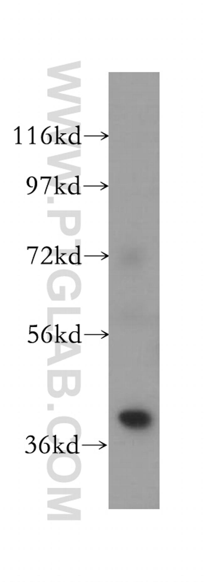 ANKRD2 Antibody in Western Blot (WB)