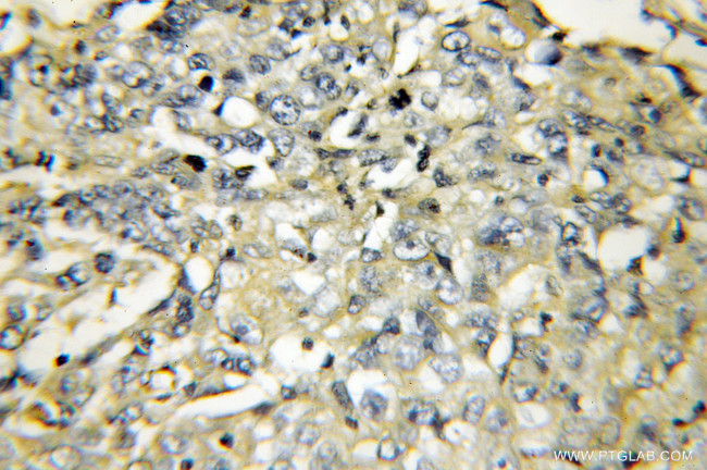 VAMP5 Antibody in Immunohistochemistry (Paraffin) (IHC (P))