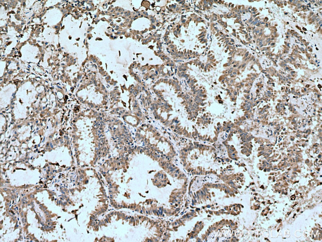 VAMP5 Antibody in Immunohistochemistry (Paraffin) (IHC (P))