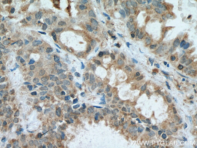 VAMP5 Antibody in Immunohistochemistry (Paraffin) (IHC (P))