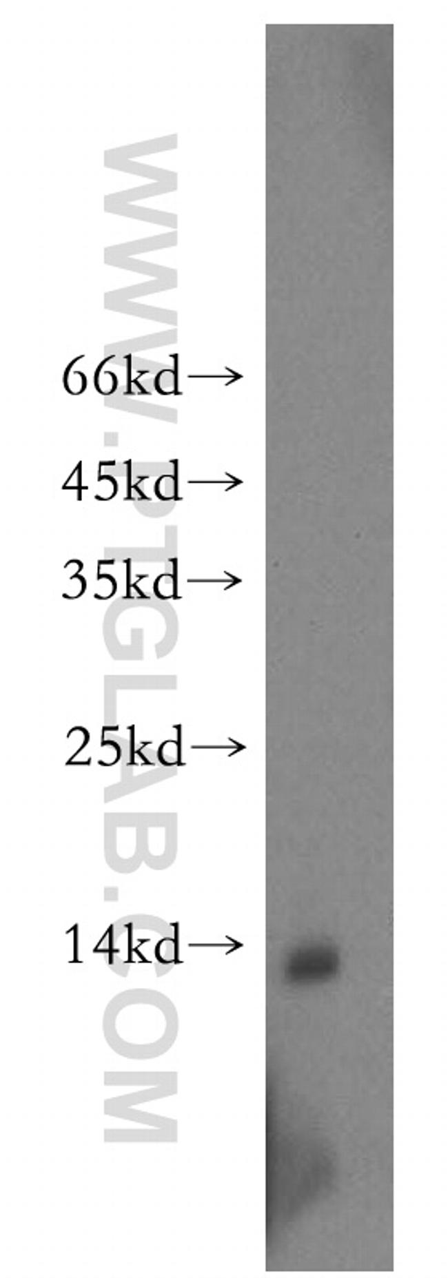 VAMP5 Antibody in Western Blot (WB)