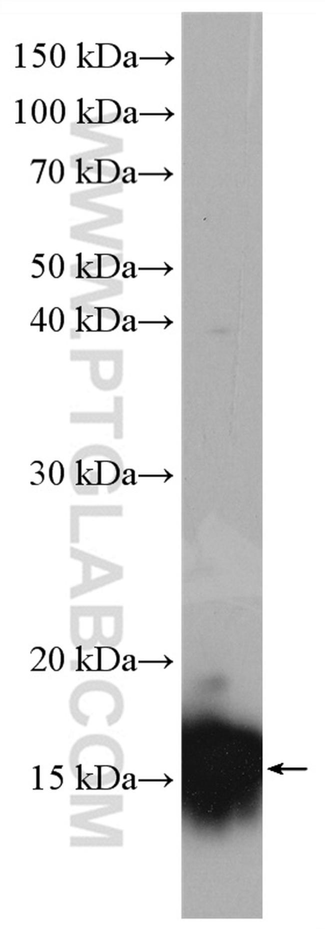 VAMP5 Antibody in Western Blot (WB)