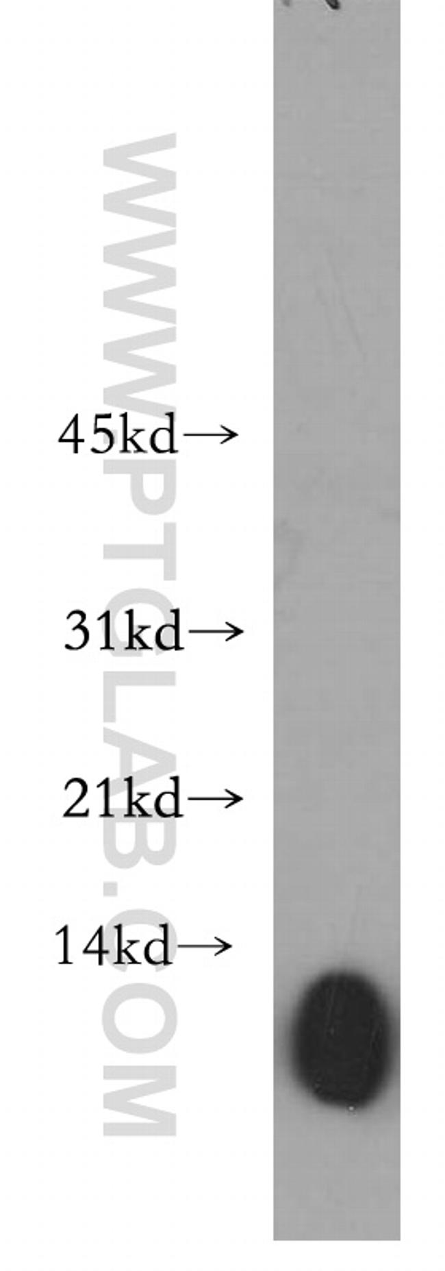 VAMP5 Antibody in Western Blot (WB)