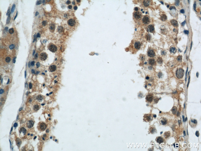 CIB1 Antibody in Immunohistochemistry (Paraffin) (IHC (P))