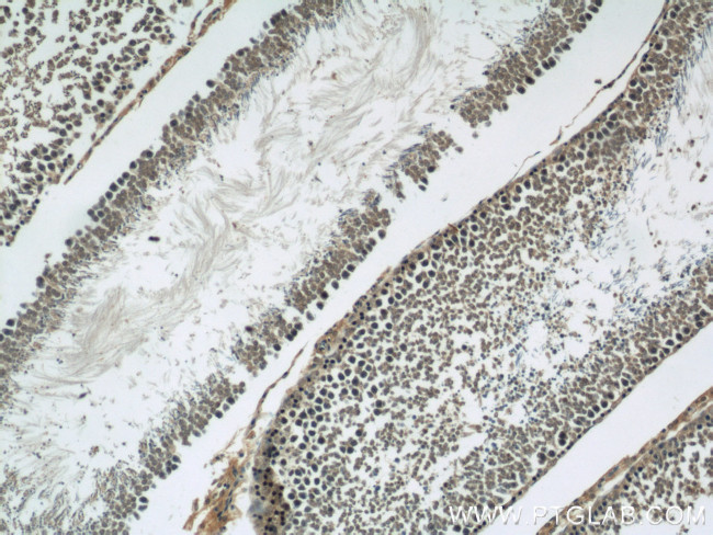 CIB1 Antibody in Immunohistochemistry (Paraffin) (IHC (P))