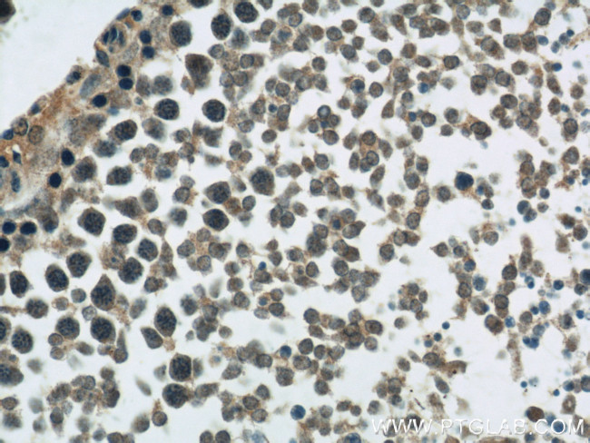 CIB1 Antibody in Immunohistochemistry (Paraffin) (IHC (P))