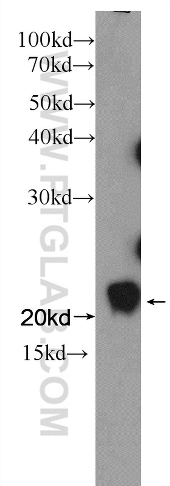 CIB1 Antibody in Western Blot (WB)