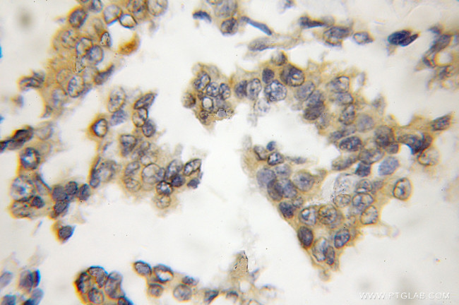 CIB1 Antibody in Immunohistochemistry (Paraffin) (IHC (P))