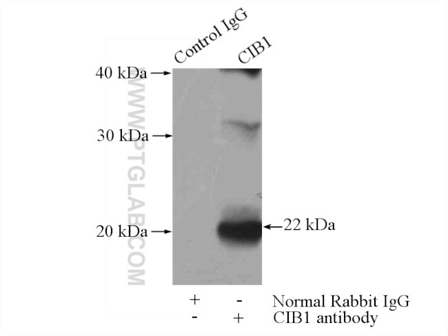 CIB1 Antibody in Immunoprecipitation (IP)