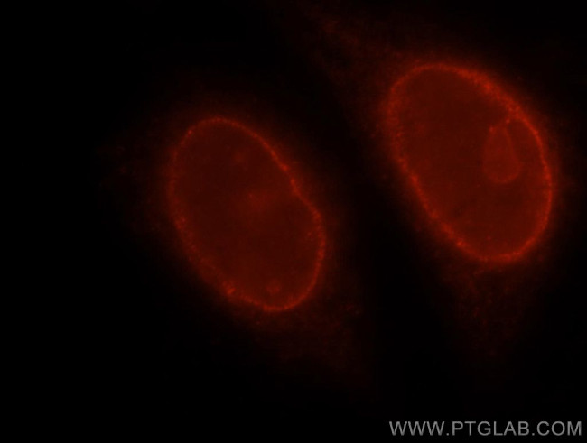 RAG2 Antibody in Immunocytochemistry (ICC/IF)