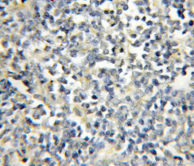 RAG2 Antibody in Immunohistochemistry (Paraffin) (IHC (P))