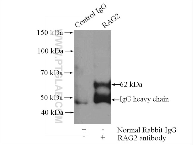 RAG2 Antibody in Immunoprecipitation (IP)