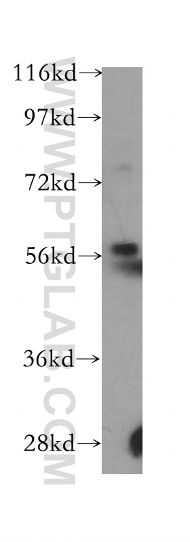 RAG2 Antibody in Western Blot (WB)