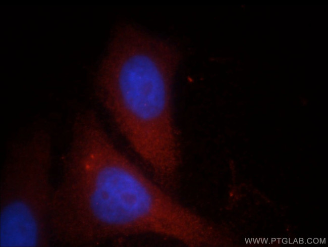 FGL2 Antibody in Immunocytochemistry (ICC/IF)