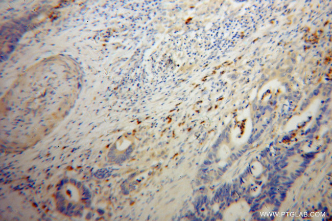 FGL2 Antibody in Immunohistochemistry (Paraffin) (IHC (P))