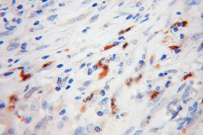 FGL2 Antibody in Immunohistochemistry (Paraffin) (IHC (P))