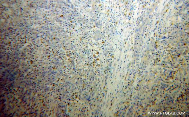 FGL2 Antibody in Immunohistochemistry (Paraffin) (IHC (P))