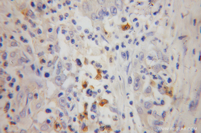 FGL2 Antibody in Immunohistochemistry (Paraffin) (IHC (P))