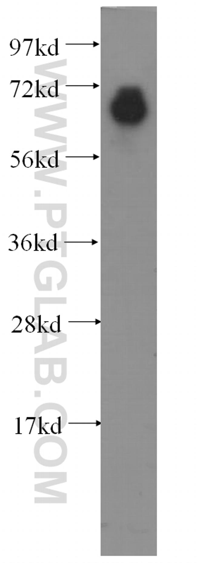 FGL2 Antibody in Western Blot (WB)