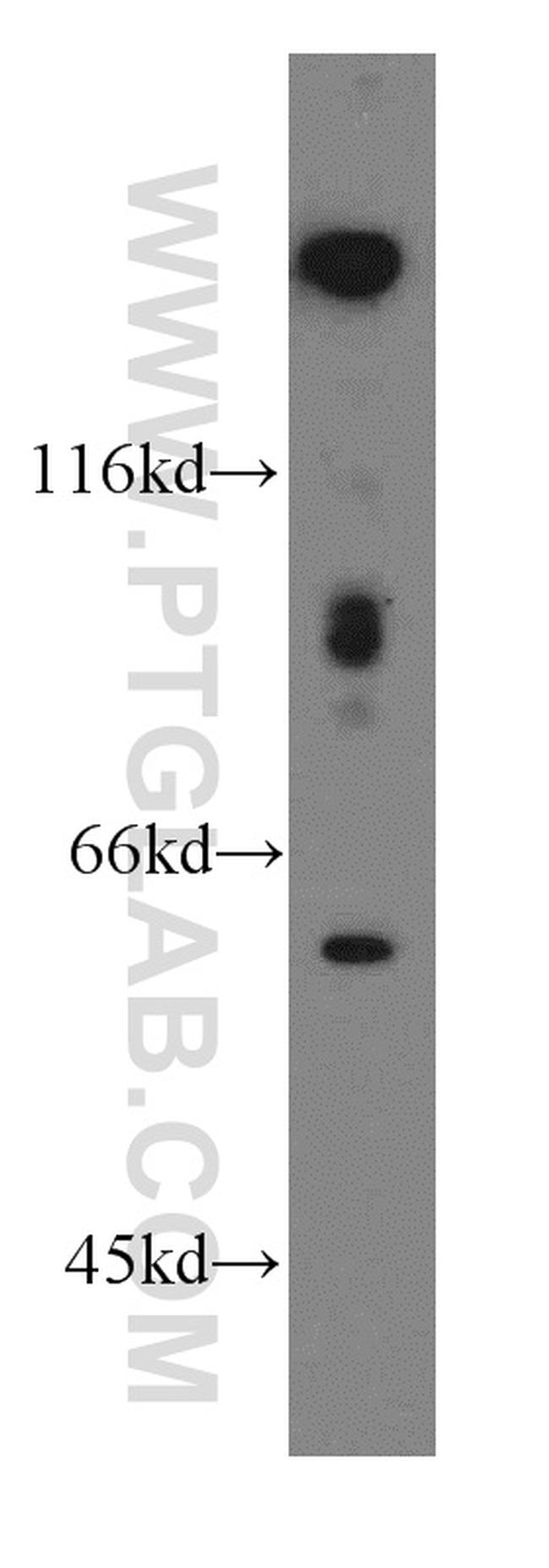 FGL2 Antibody in Western Blot (WB)