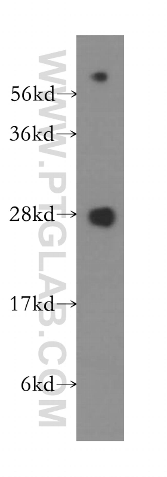 CBX5 Antibody in Western Blot (WB)